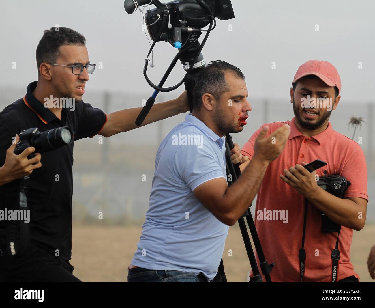 21. August 2012: Gaza, Palästina. 21. August 2021. Assem Shehadeh, ein Fotograf der National Agency, wird bei einer Demonstration im Flüchtlingslager Malika im Osten von Gaza City durch einen Schrapnel im Gesicht verletzt. Am 52. Jahrestag des Verbrennungsversuchs der Al-Aqsa-Moschee in Jerusalem kam es zu Zusammenstößen zwischen den Demonstranten und der israelischen Armee. Nach Angaben des Gesundheitsministeriums von Gaza wurden während der Zusammenstöße mehr als 40 Palästinenser von israelischen Truppen verletzt, darunter zwei von ihnen, darunter ein 13-jähriger Junge. Ein israelischer Soldat wurde ebenfalls während des Ereignisses verletzt ( Stockfoto