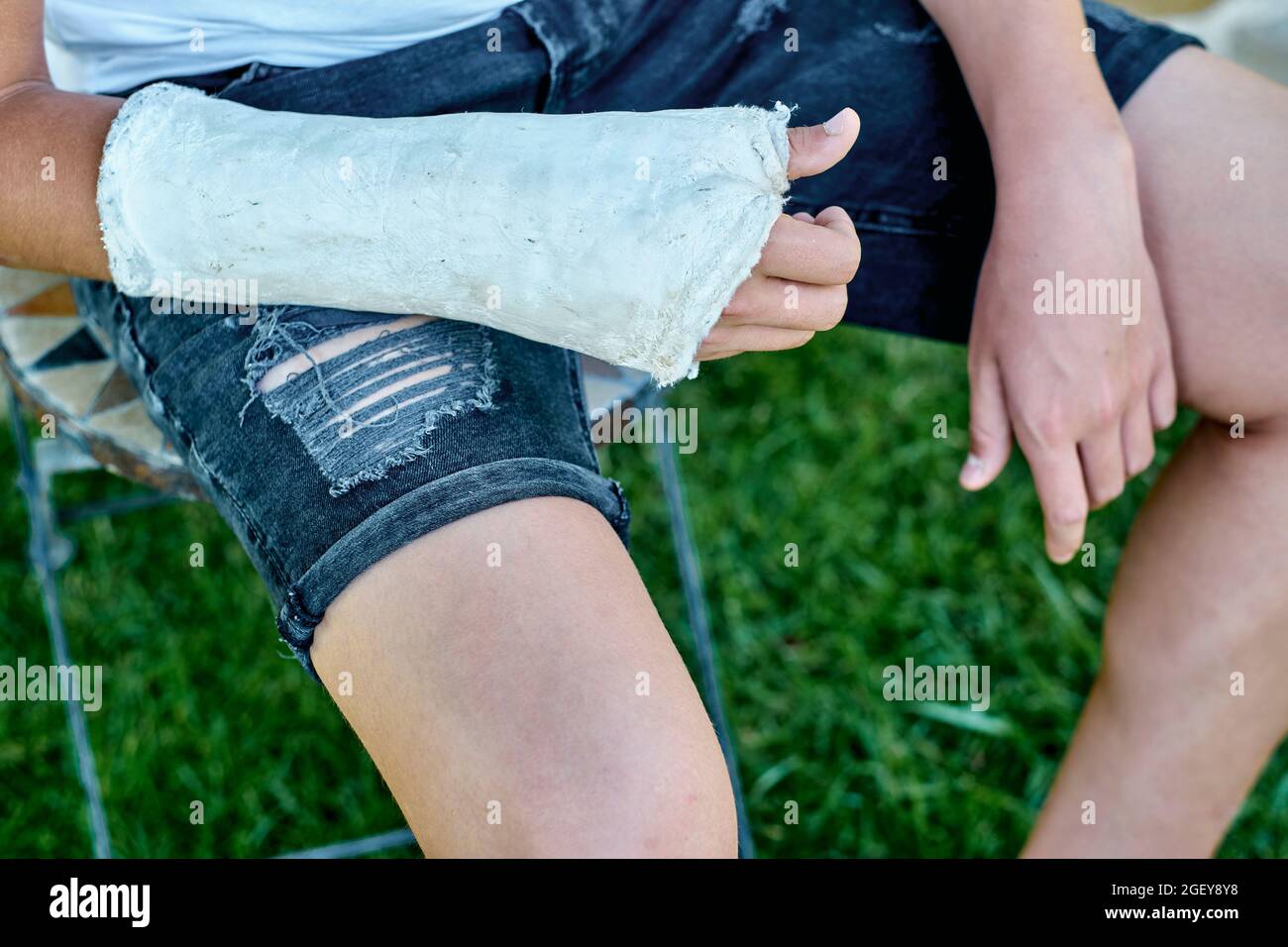 Nahaufnahme eines Jungen mit einem gebrochenen und gegossenen Arm, der im Garten auf einem Stuhl sitzt. Lifestyle-Konzept. Stockfoto