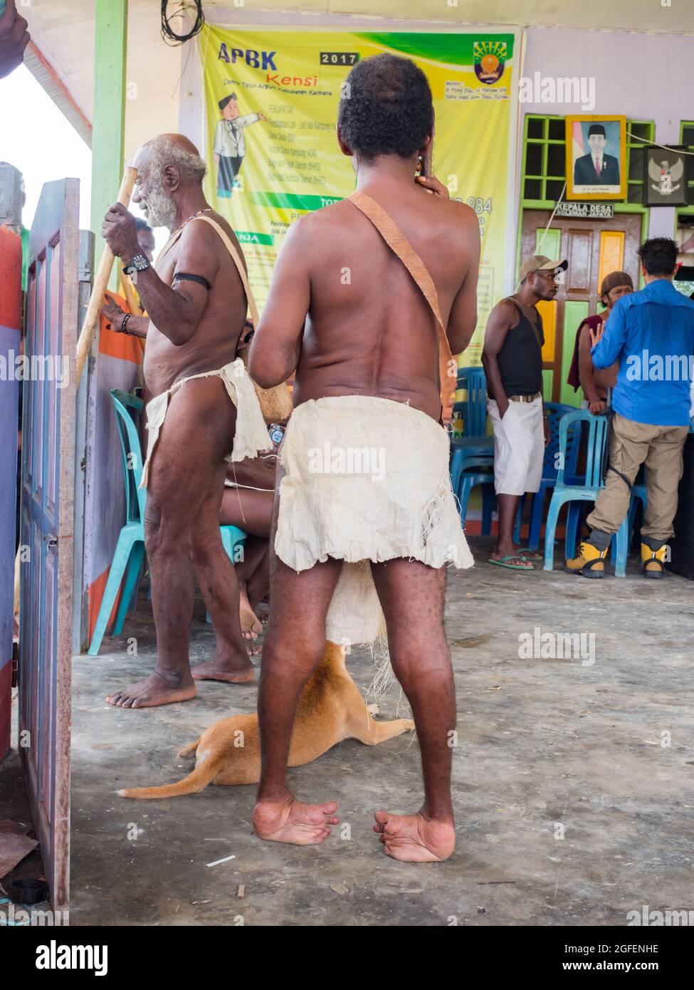 Bird's Head Peninsula, West Papua, Indonesien, Asien - 2018. Feb: Eine Person mit Beinverformungen aufgrund von Polio oder anderen Krankheiten in der Mitte des Indons Stockfoto