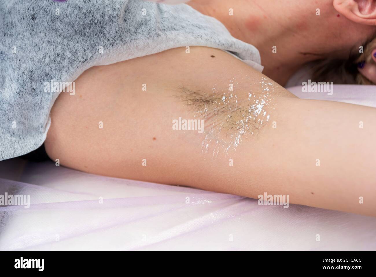Der Kosmetologe bereitet die Achselhöhlen des Mädchens auf die Enthaarung in einem Spa-Salon mit Talkum vor Stockfoto