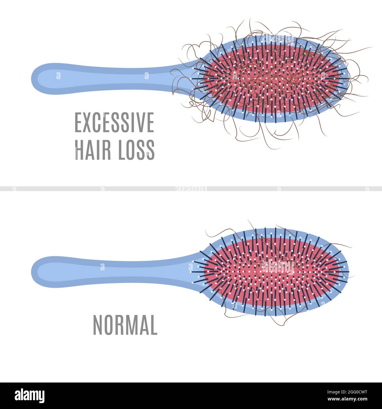 Haarbürste mit Haaren bedeckt, Illustration. Stockfoto