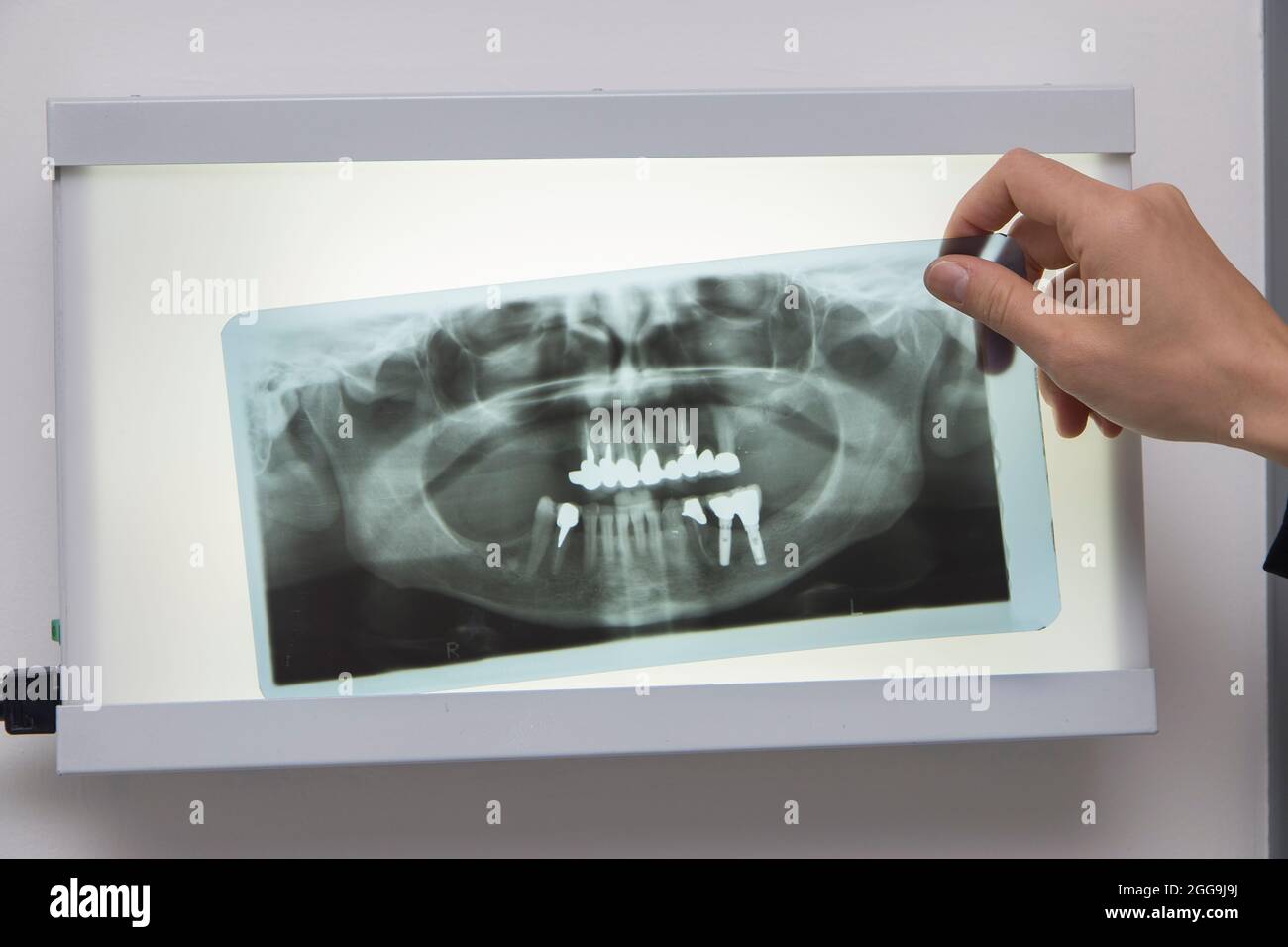 Nahaufnahme Detail der Zahnarzt Arbeitswerkzeuge, keine Menschen sind sichtbar. Stockfoto