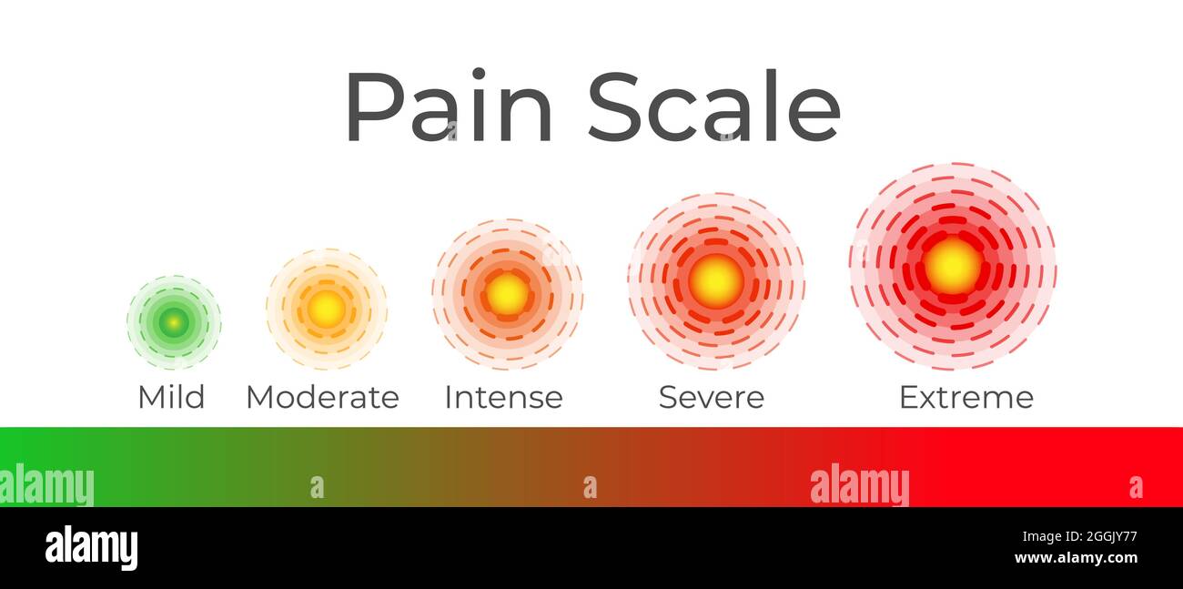 Infografik Zur Schmerzskala – Hintergrunddarstellung Stock Vektor