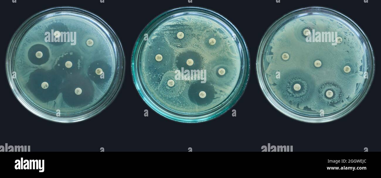 Antibiotikaresistenz-Suszeptibilitätstests durch Diffusion kirby bauer Stockfoto