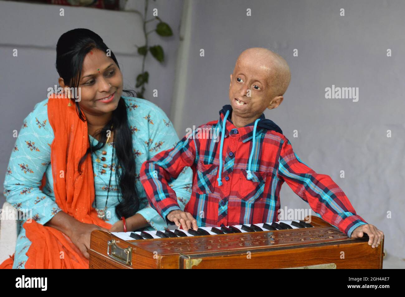 Shreyash Barmate, 13 Jahre alt, leidet an Progeria, in Jabalpur. Foto Von - Uma Shankar Mishra Stockfoto
