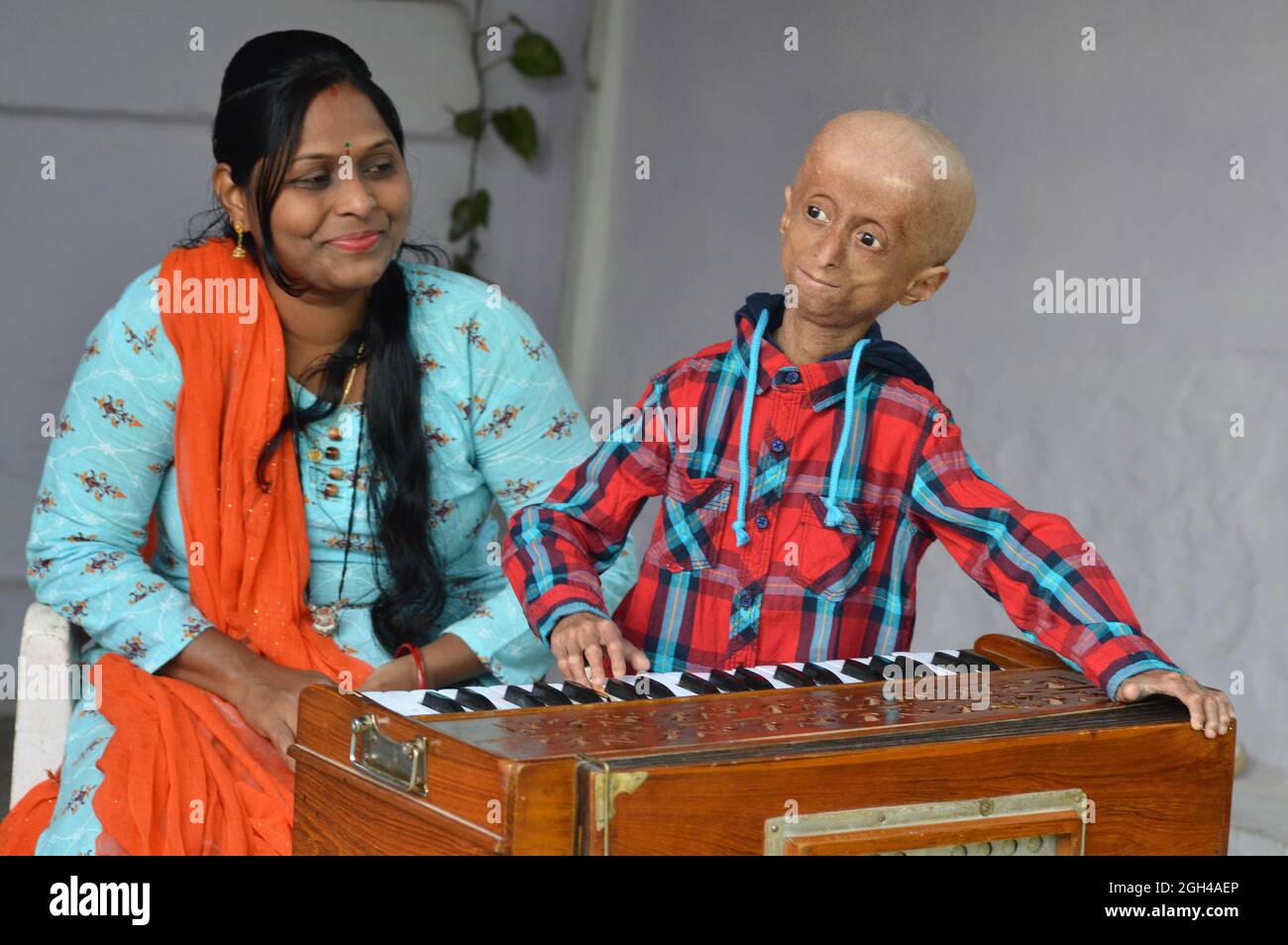 Shreyash Barmate, 13 Jahre alt, leidet an Progeria, in Jabalpur. Foto Von - Uma Shankar Mishra Stockfoto