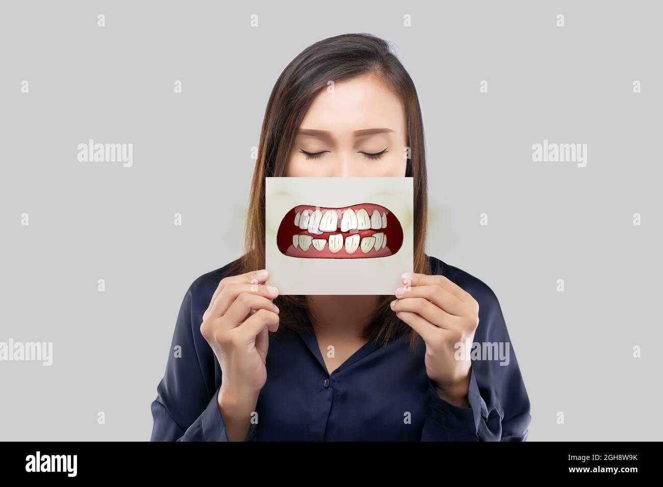 Asiatische Frauen mit schlechter Mundgesundheit Stockfoto