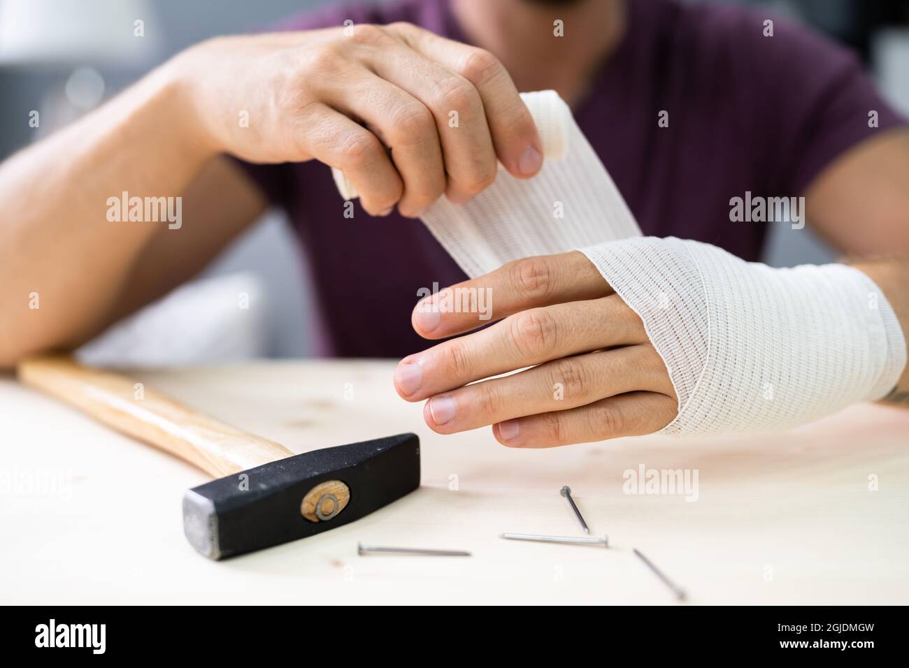 Hand- Und Fingerverband Nach Hammerunfall. Verletzter Fingernagel Stockfoto