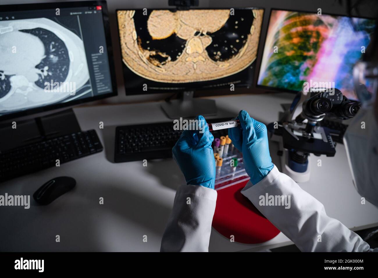 Bluttests für das Covid-19-Screening und Röntgen- oder CT-Bilder infizierter Patienten. Stockfoto