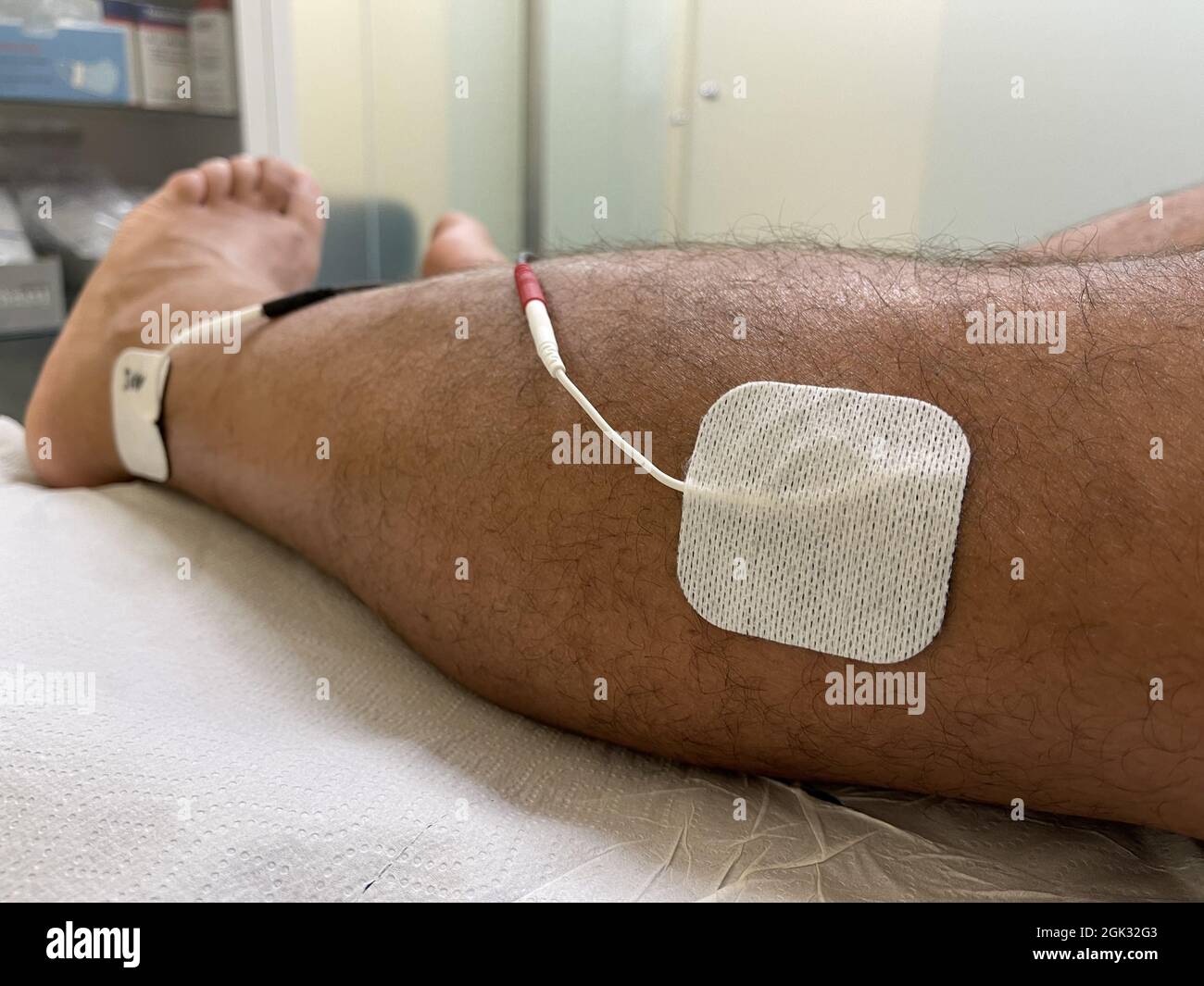 Nahaufnahme von zwei Elektroden, die auf das Bein des Mannes gelegt wurden, um überaktive Blasensymptome zu lindern Stockfoto