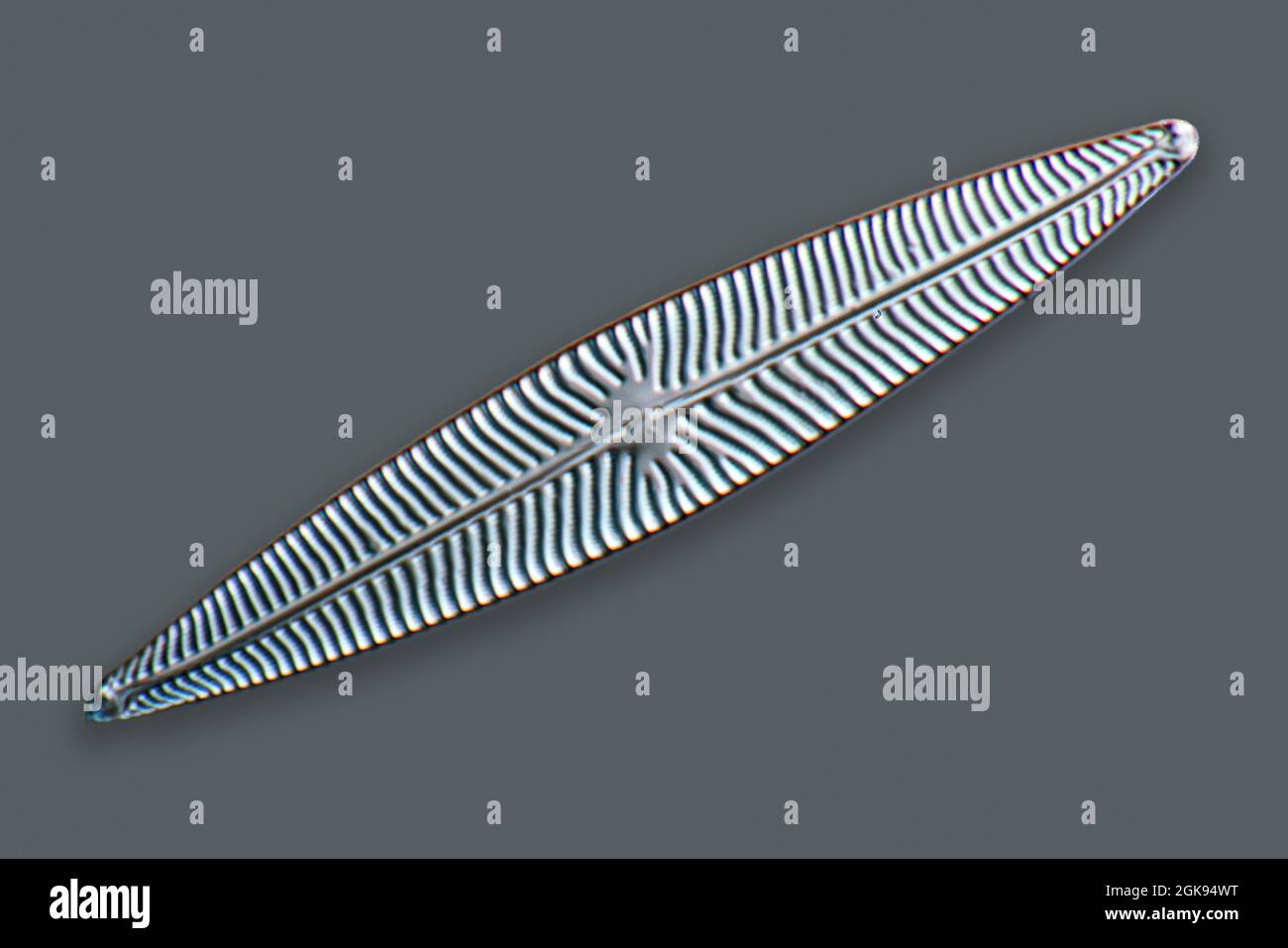 Kieselalgen (Diatomeae), Kieselalgen von Marienwerden, Differentielle Interferenzkontrast-Mikroskopie, Vergrößerung x 140 bezogen auf einen Druck von 35 mm, Deutschland, Stockfoto