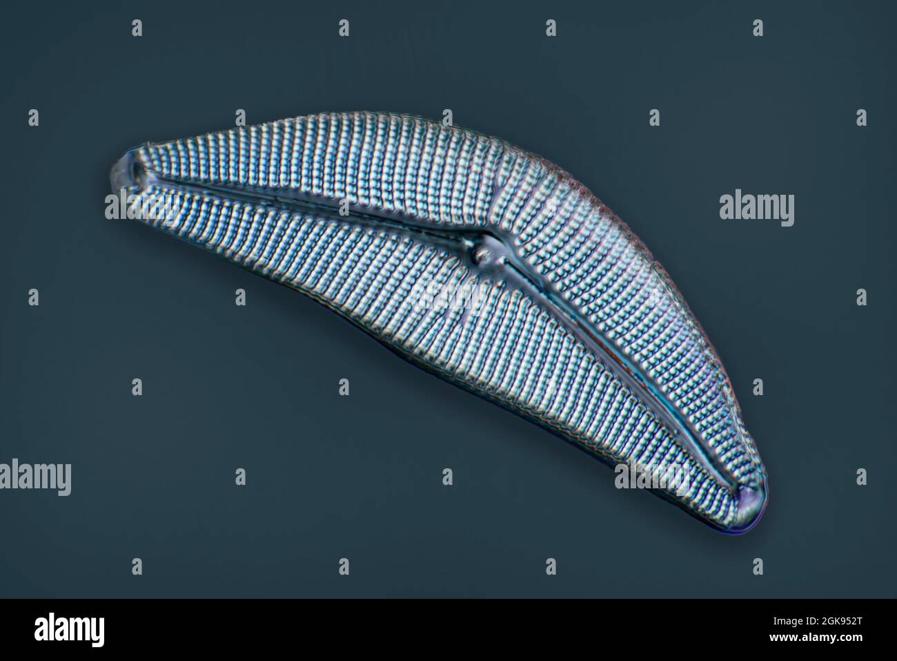 Diatom (Diatomeae), Diatome von Emeralda, Lichtmikroskopie, differentieller Interferenzkontrast, Vergrößerung x 140 bezogen auf einen Druck von 35 mm Stockfoto