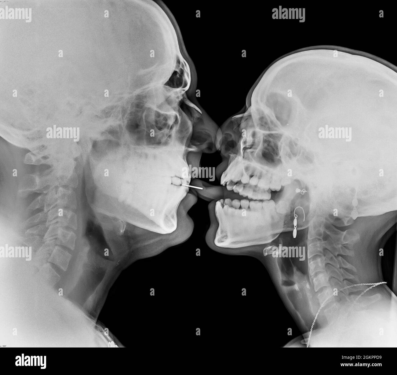 Küssendes Paar. Zwei Menschen, die sich unter einer röntgendurchbohrten Zunge küssen, sind zu sehen Stockfoto