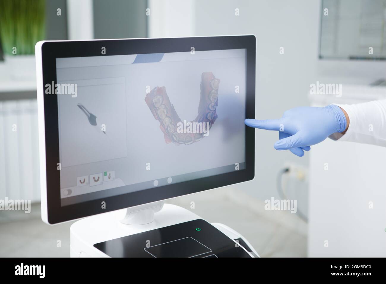 Der Zahnarzt zeigt auf den Dental Scan auf dem Computerbildschirm Stockfoto