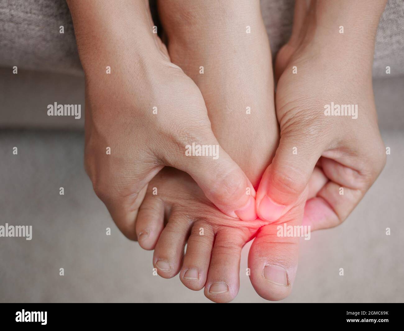 Nahaufnahme einer Frau, die ihre schmerzhaften Füße hält und ihre Bunion-Zehen massiert, um Schmerzen zu lindern. Geschwollene Bunion am Rand der Großzehe verursacht Deformität ( Stockfoto