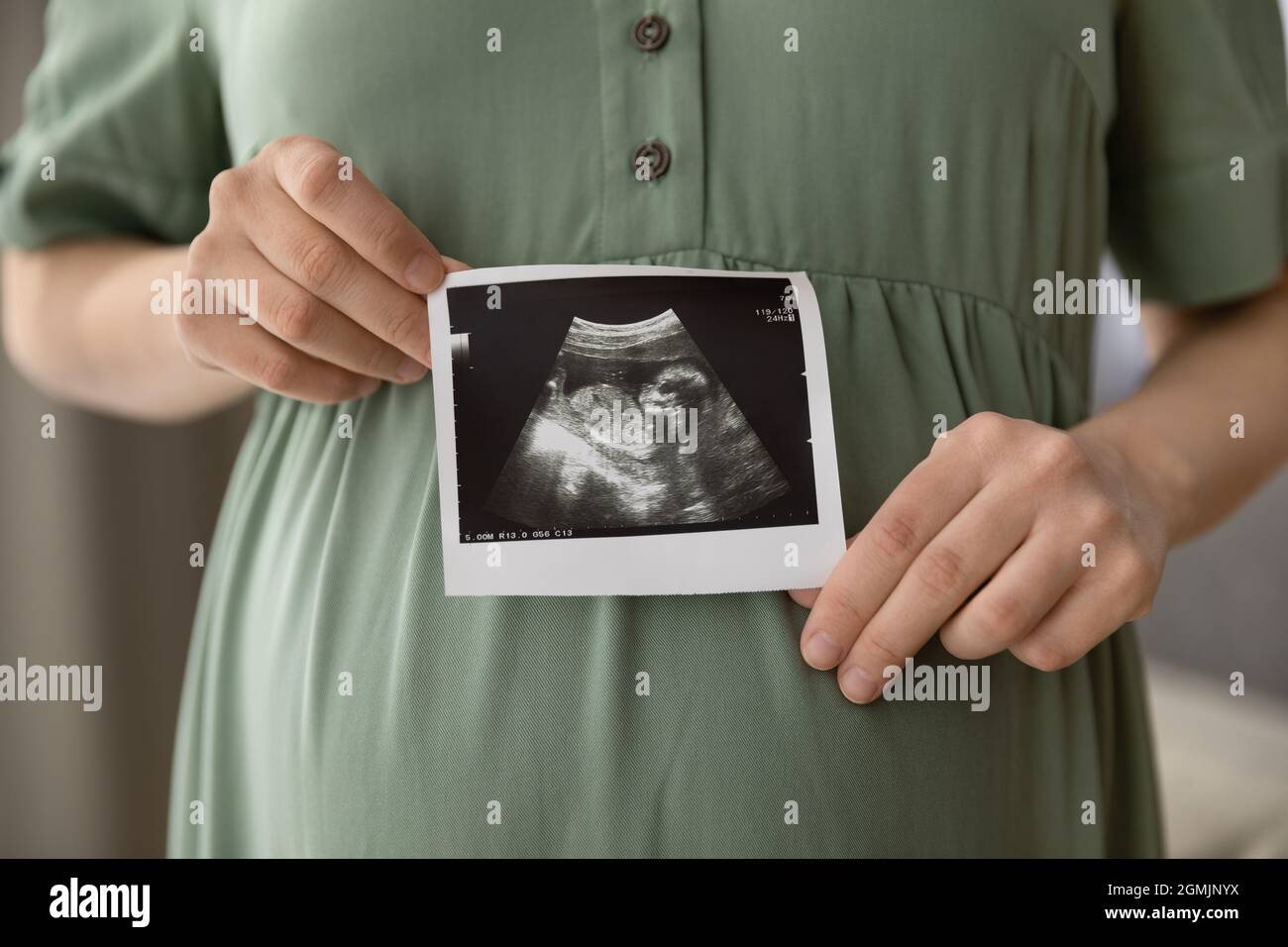 Junge Schwangerin mit Sonogrammbild ihres ungeborenen Babys Stockfoto