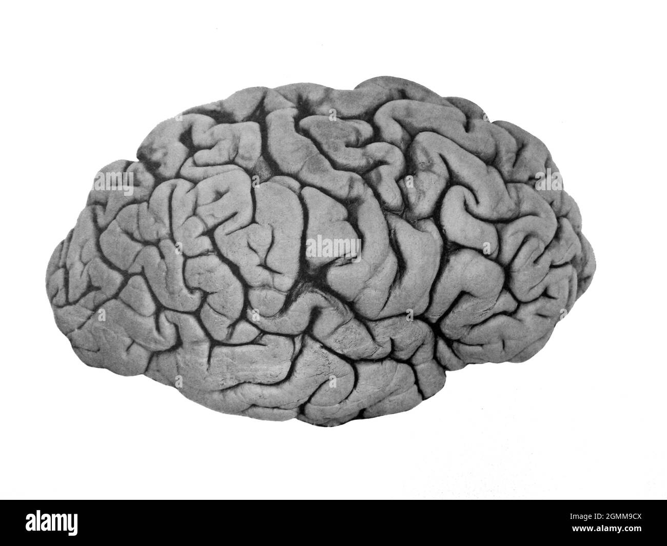Illustration des menschlichen Gehirns aus einem medizinischen Lehrbuch um 1900 Stockfoto
