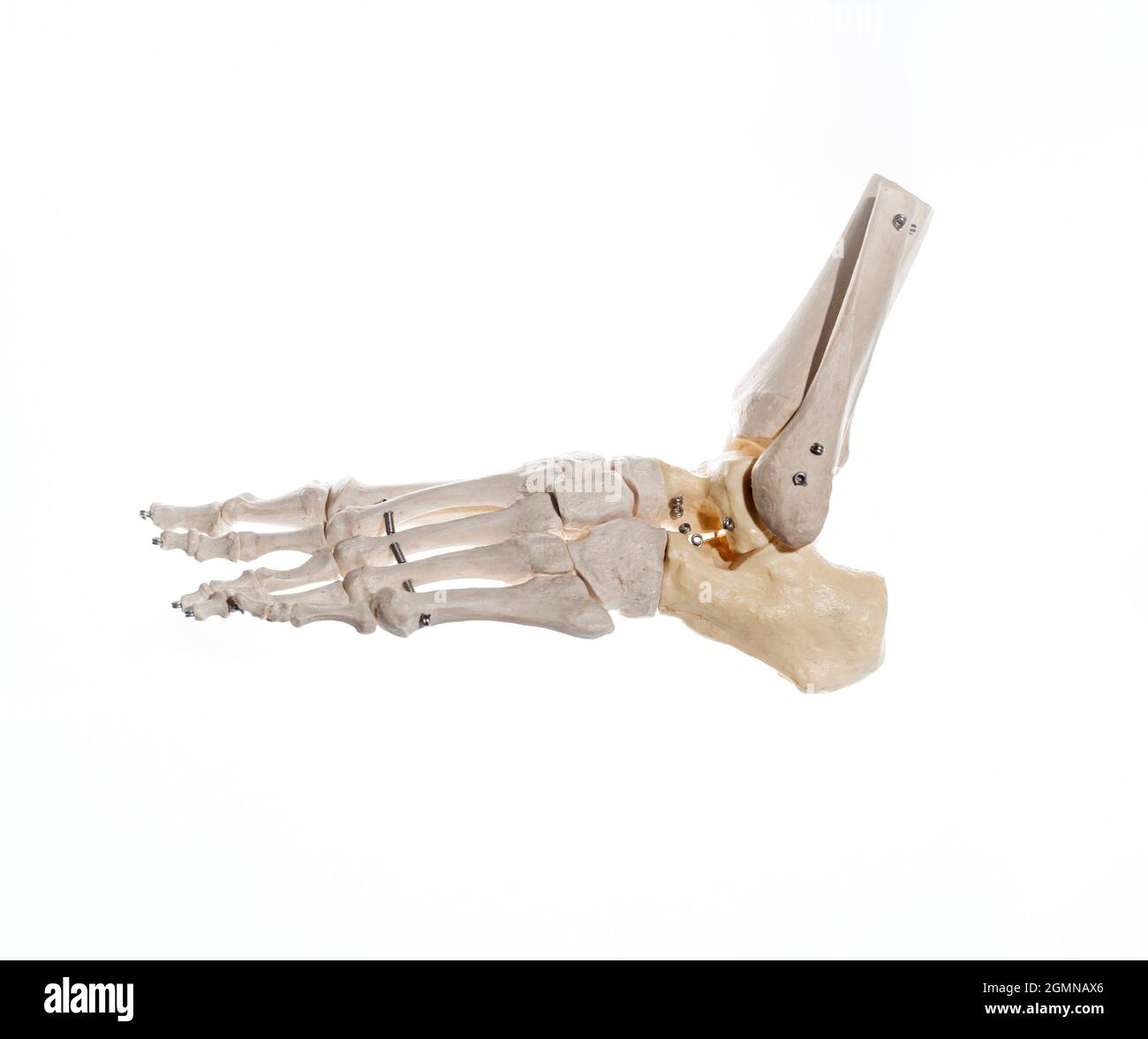 Außenansicht des Skeletts eines gelenkten menschlichen Fußes, mit dem distalen Teil des Schienbeins und der Fibel auf Draht montiert. Anatomiekonzept Stockfoto