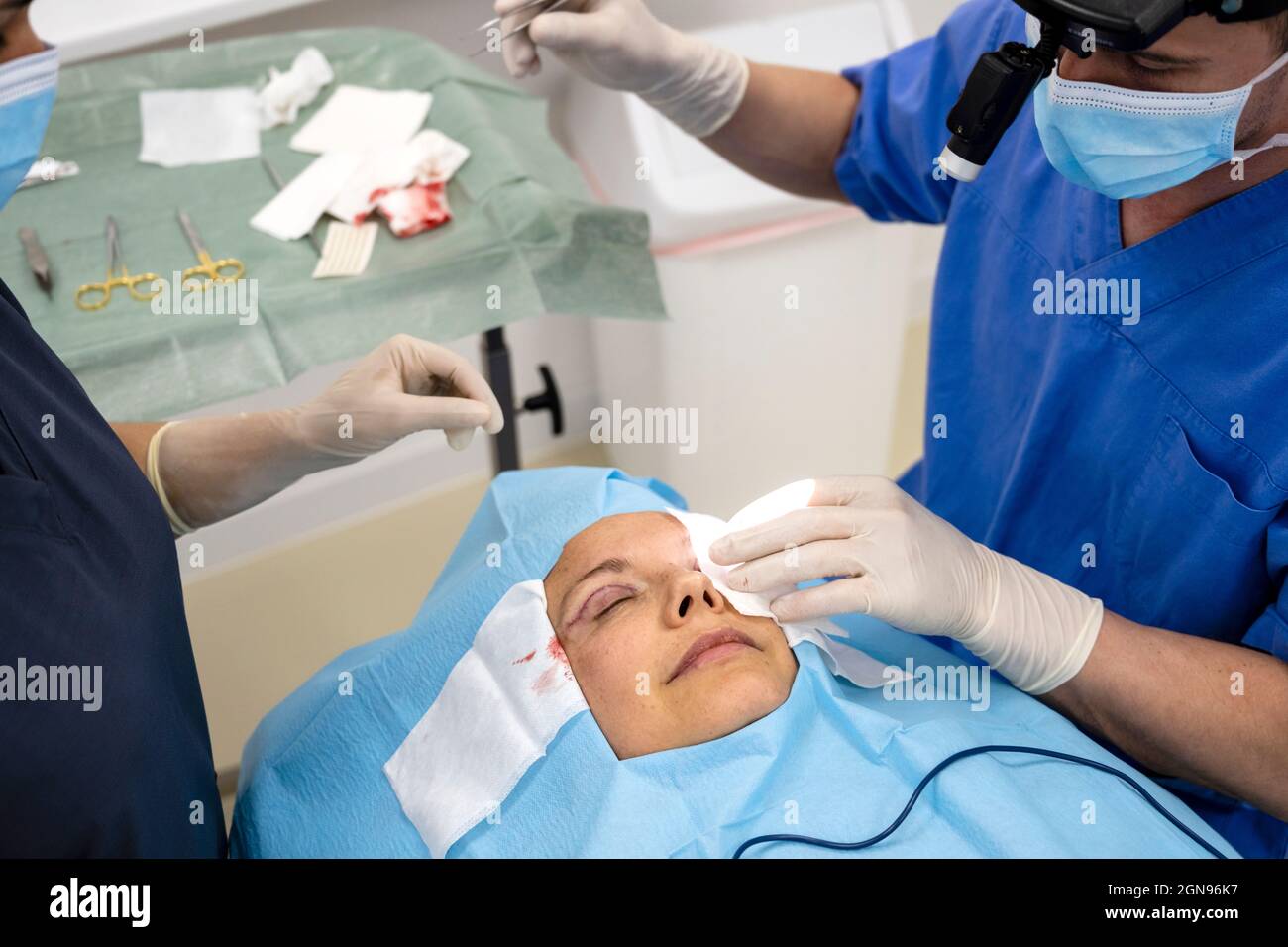 Chirurgen, die eine Augenlid-Operation an anonymen Patienten durchführen Stockfoto