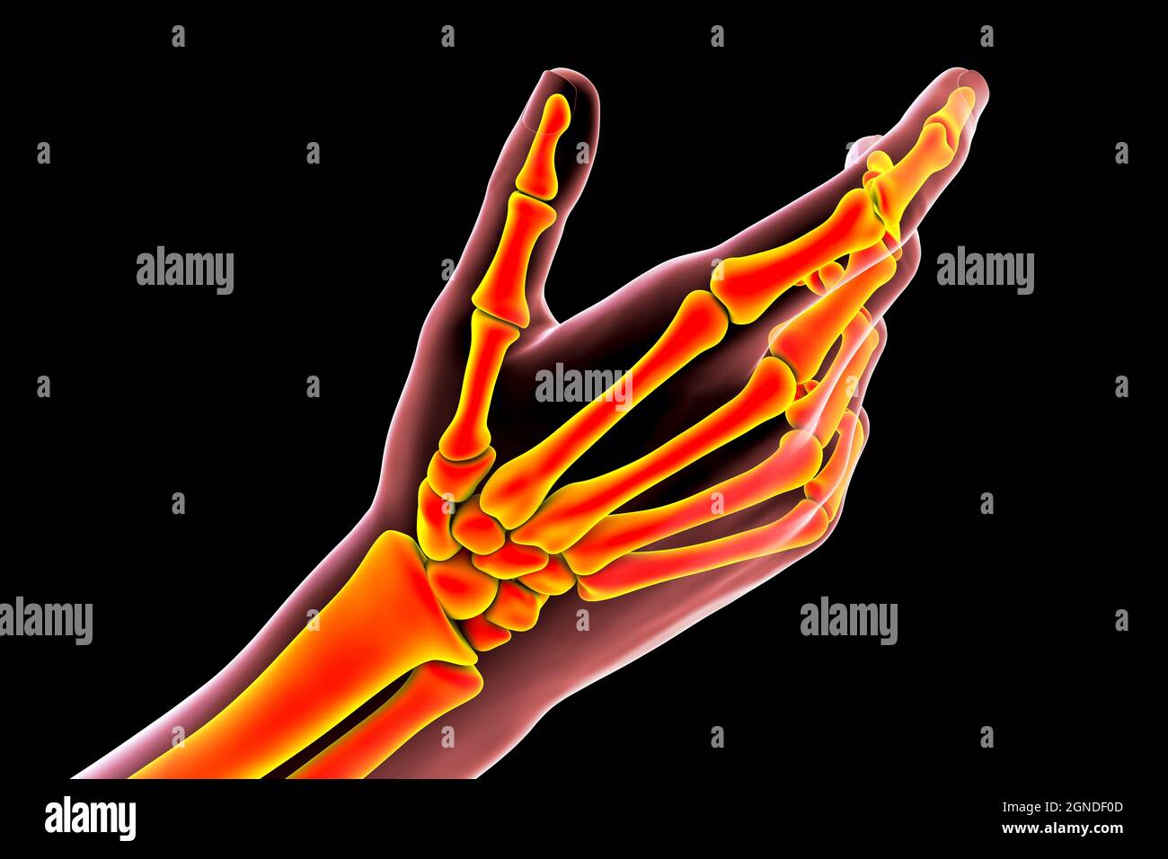Menschliche Hand Knochen, Abbildung Stockfoto