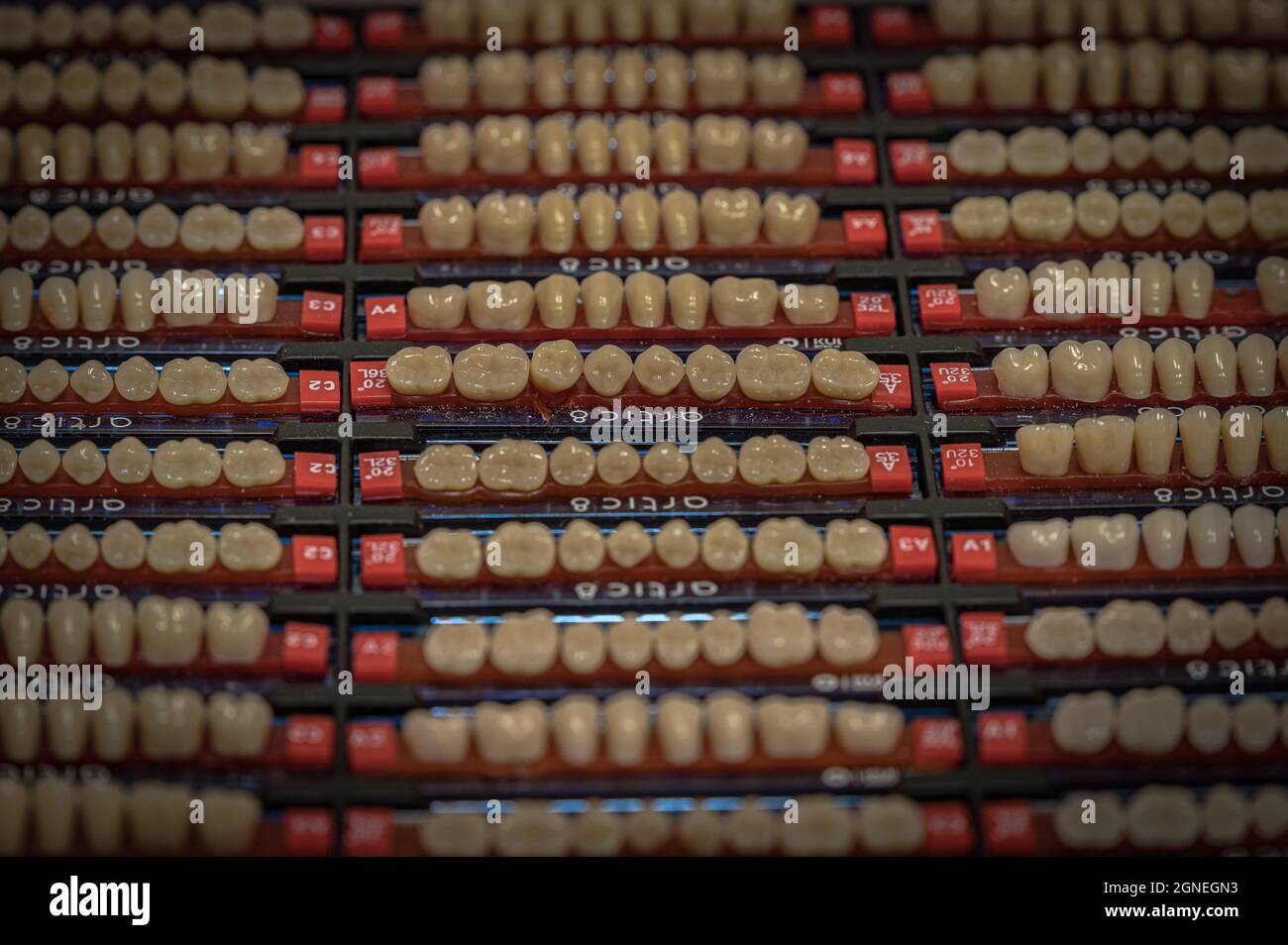 Proben von menschlichen künstlichen Zähnen für einen Zahntechniker, um einen Ersatz für heruntergefallene Zähne zu schaffen Stockfoto