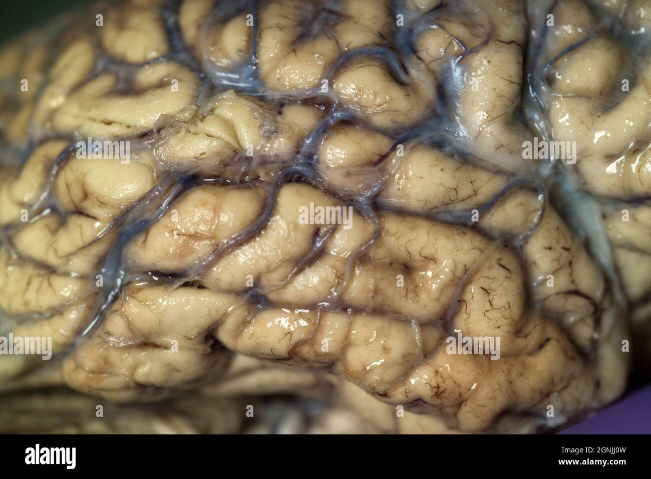 Nahaufnahme der Oberfläche eines menschlichen Gehirns. Stockfoto