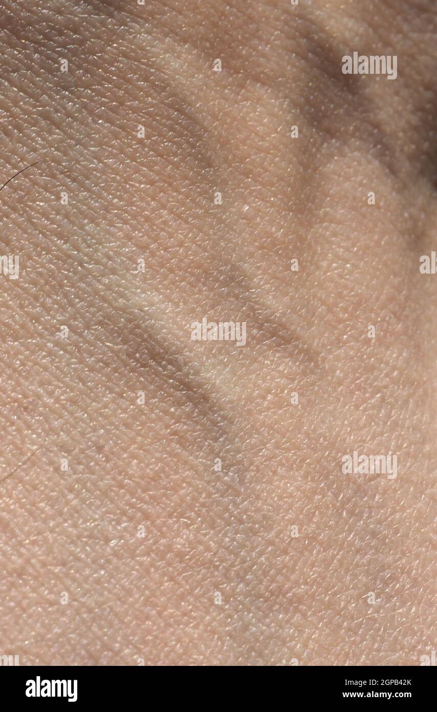 Venen in einem menschlichen Arm, sichtbar unter der Haut Stockfotografie Alamy