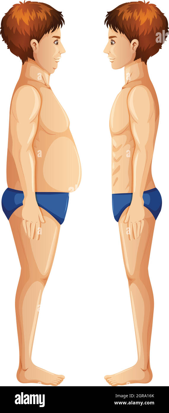 Der menschliche Körper ist fett und schlank Stock Vektor