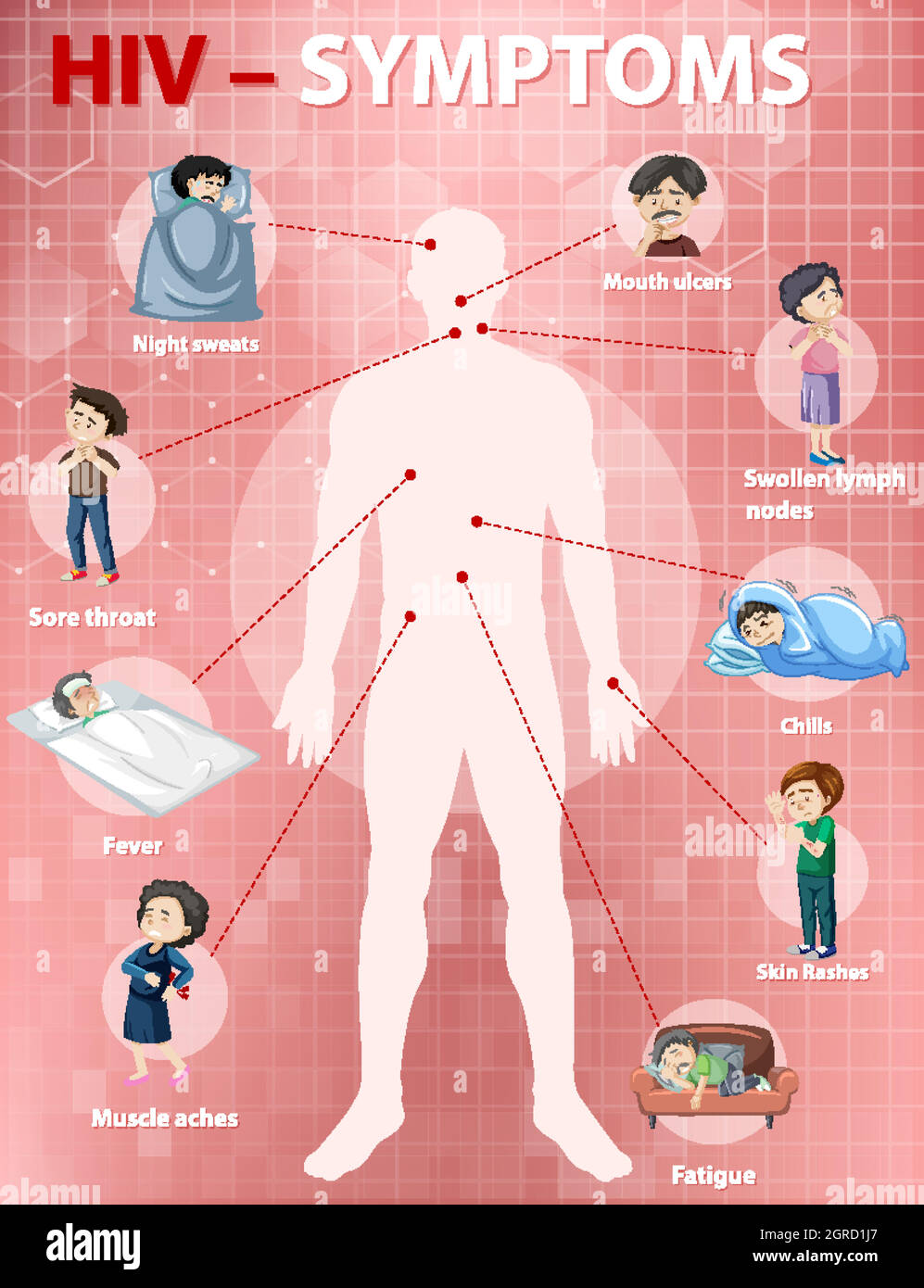 Infografik zu den Symptomen einer HIV-Infektion Stock Vektor