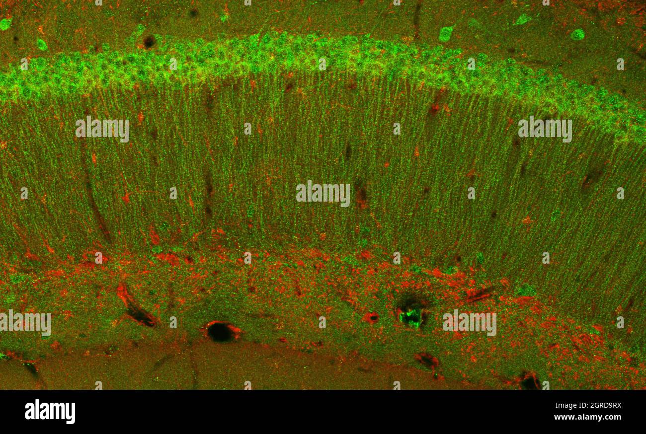 Gehirnrinde und Teil des Hippocampus darunter in einem Abschnitt eines Maushirns, mit Immunfluoreszenz markiert und mit konfokalem Laser aufgezeichnet Stockfoto