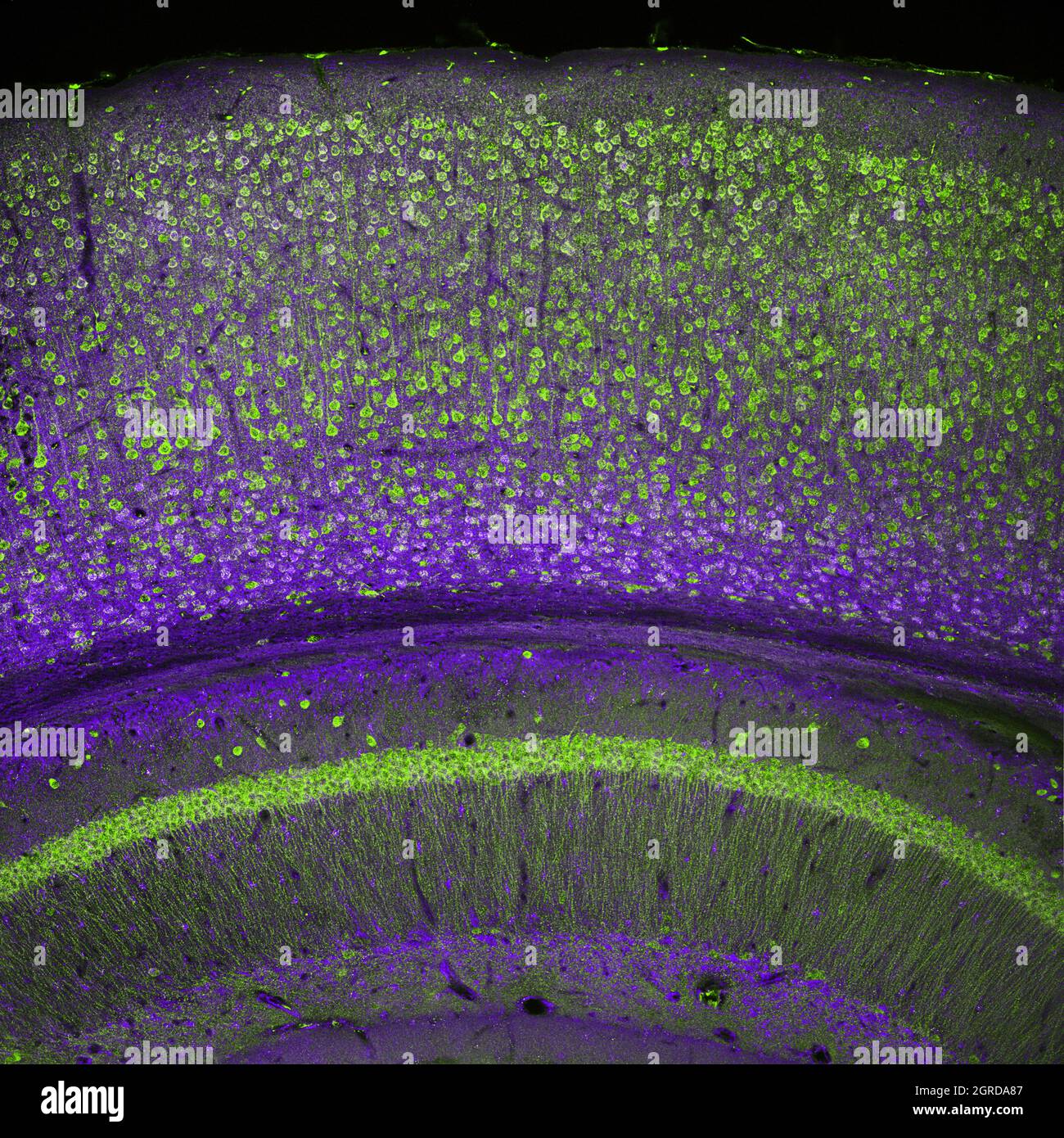 Gehirnrinde und Teil des Hippocampus darunter in einem Abschnitt eines Maushirns, mit Immunfluoreszenz markiert und mit konfokalem Laser aufgezeichnet Stockfoto