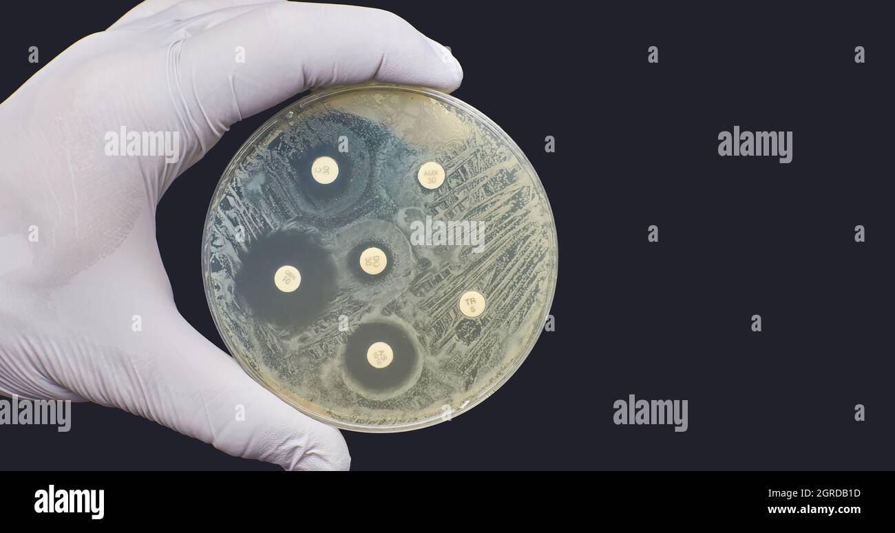 Antibiogramm Kirby Bauer Antimikrobielle Resistenz gegen Resistenz Diffusionstest Stockfoto