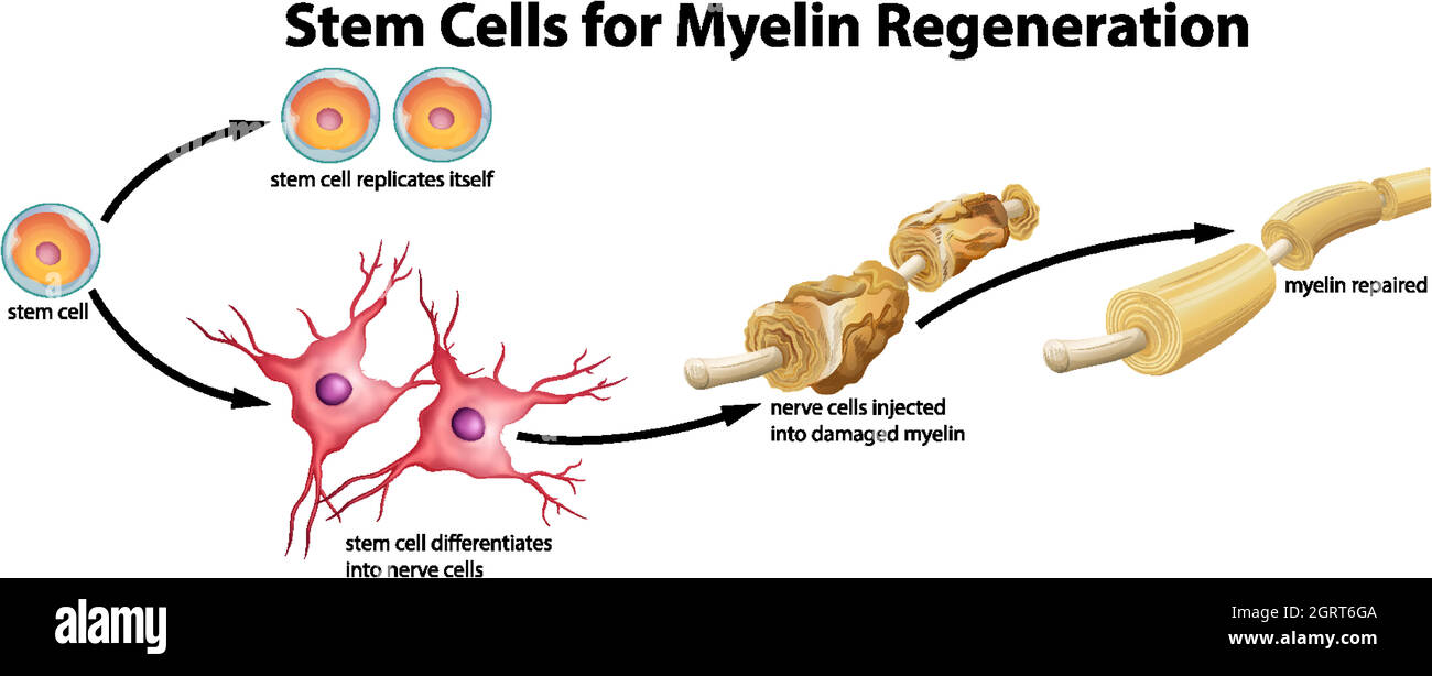 Stammzellen für die Myelinregeneration Stock Vektor