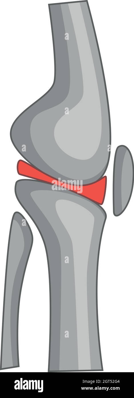 Knie-totalendoprothese Chirurgie Symbol, Cartoon Stil Stock Vektor