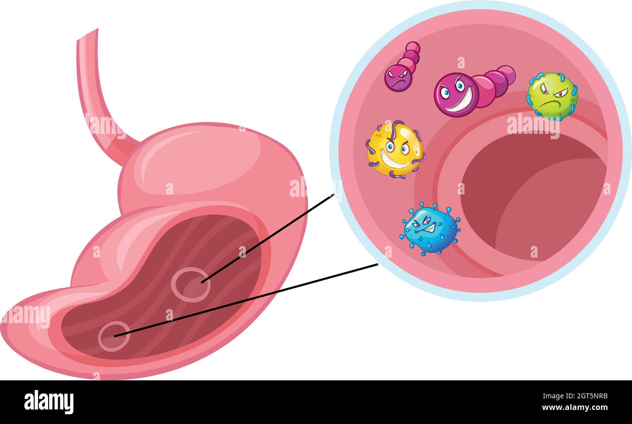Viele Viren im menschlichen Magen Stock Vektor