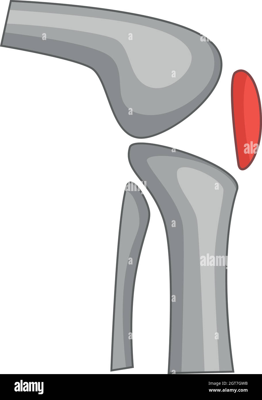Kniegelenkersatz Symbol Implantat, Cartoon Stil Stock Vektor