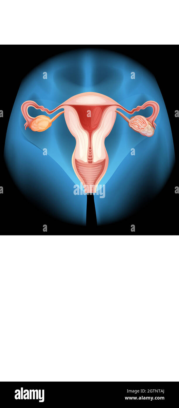 Röntgenstrahlen von menschlichem Overian Stock Vektor