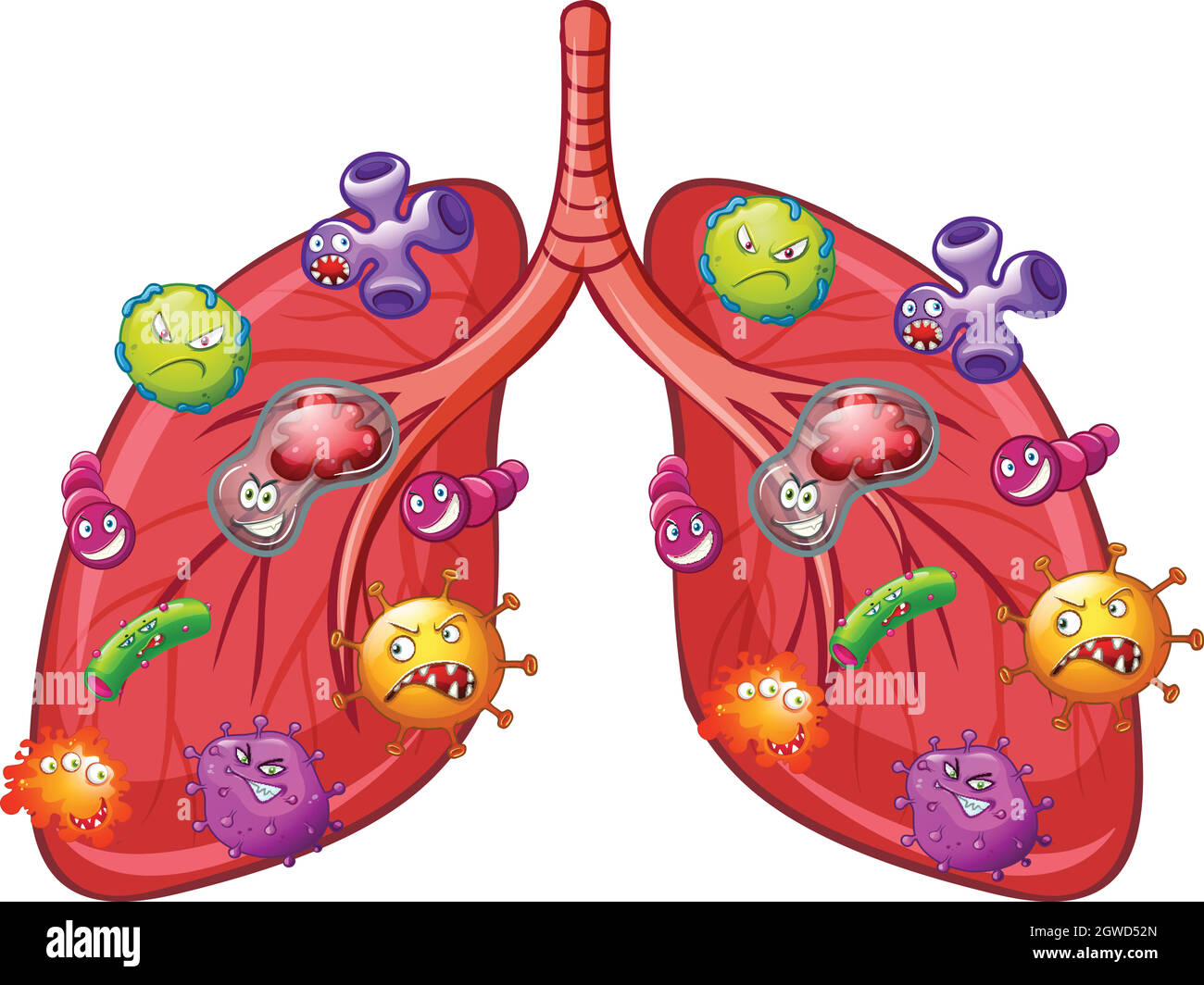 Ein Vektor von Lungenbakterien Stock Vektor