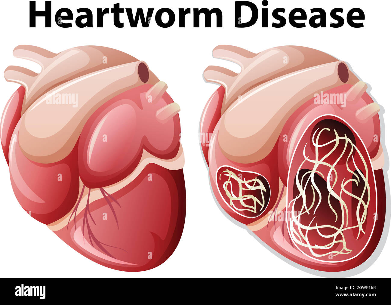 Herzwurm-Krankheit Diagramm weißer Hintergrund Stock Vektor