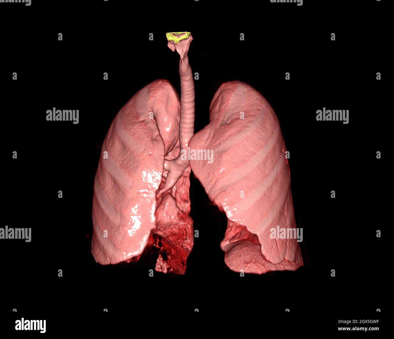 3d-Renderings der menschlichen Lunge, die das Atmungssystem zeigt. Stockfoto