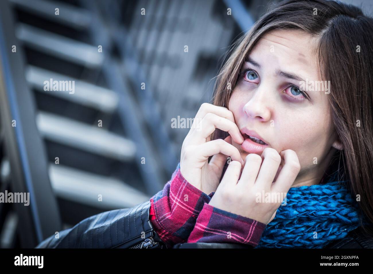 Junges Mädchen mit schweren Blutergüssen und Angst auf der Treppe. Stockfoto