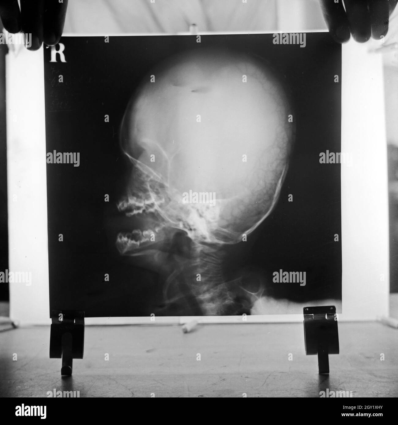 Reproduktion eines Röntgenbilds eines Schädels, Deutschland 1930er Jahre. Reproduktion von einem Röntgenbild eines Schädels, Deutschland 1930. Stockfoto