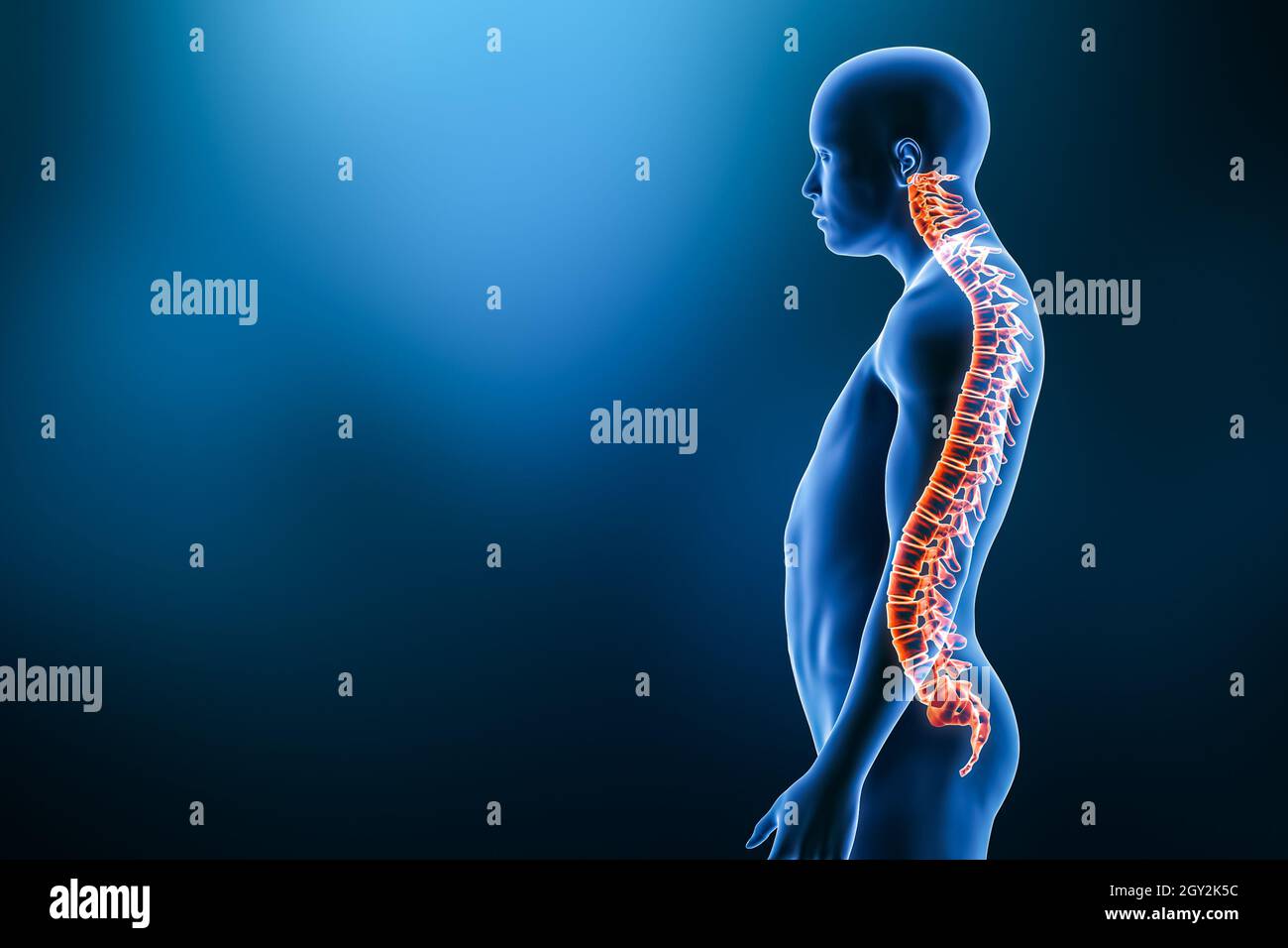 Lordose Pathologie mit man-Modell aus der lateralen Ansicht 3D-Rendering-Illustration mit Kopierraum. Menschliche Anatomie, Wirbelsäulenerkrankungen oder Deformität, Krümmung Stockfoto