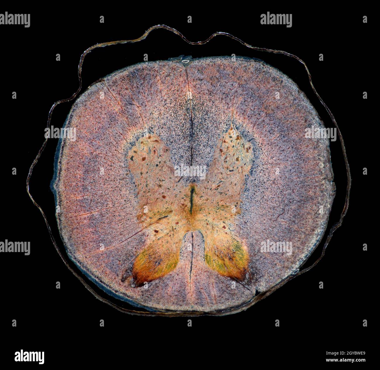 Rückenmark der Säugetiere, TS Stockfoto