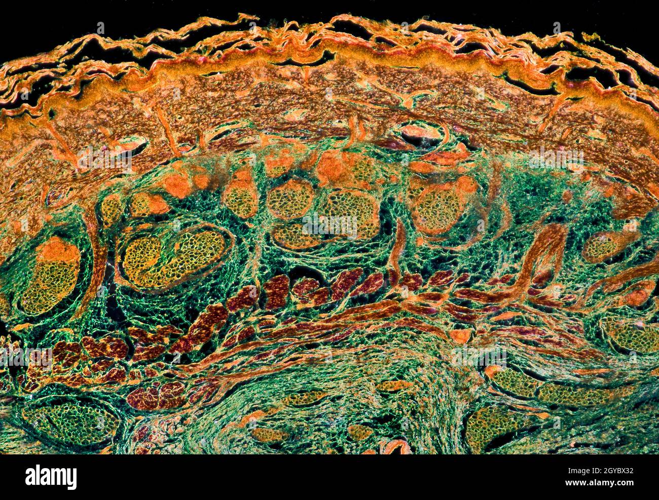 Schweißdrüse in der Haut, Dunkelfeld-Photomikrograph, gefärbter Abschnitt Stockfoto