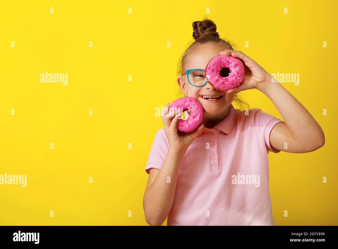 Glückliches Mädchen mit Down-Syndrom. Spaß haben, lachen. Lustige Zöpfe ...