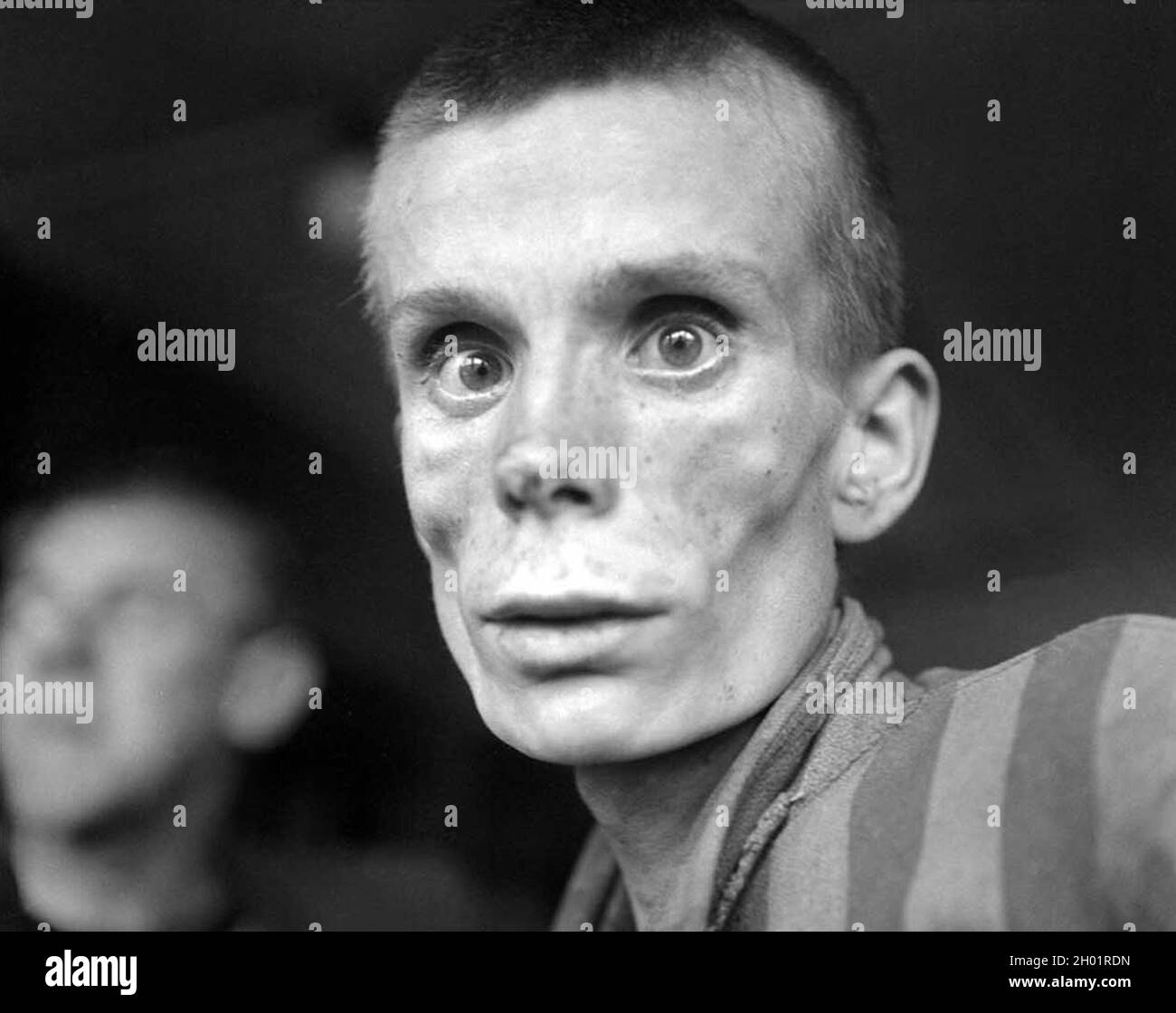 Der heimtsuchende Blick eines abgemagerten 18-jährigen russischen Mädchens während der Befreiung des Konzentrationslagers Dachau im Jahr 1945. Stockfoto