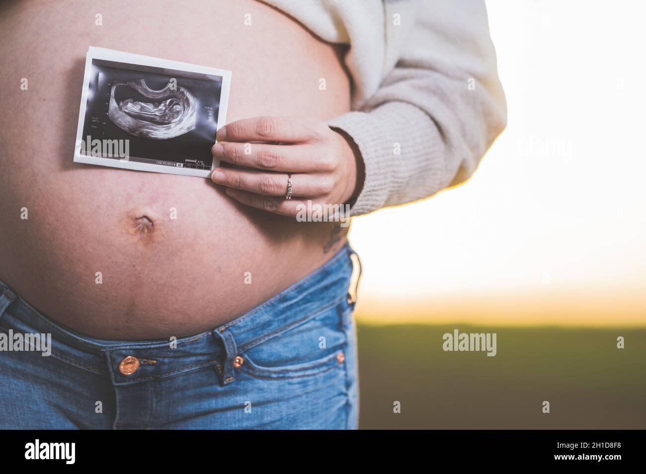 Eine schwangere Frau hält ein Foto von ihrem Baby, Ultraschall Bild. Im Freien . Stockfoto