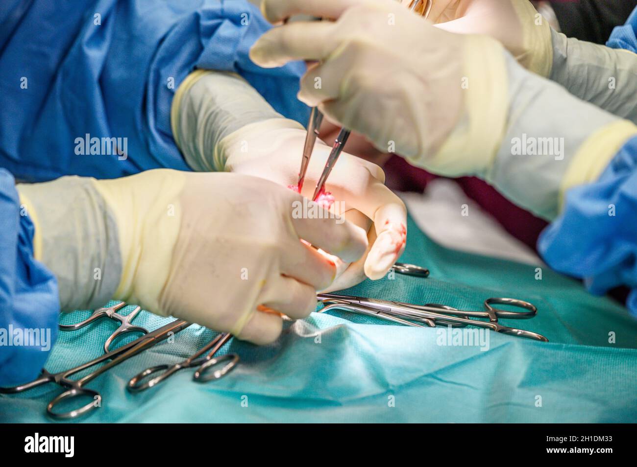 Nahaufnahme, Hände des professionellen Chirurgen, der operiert. Im Hintergrund Modern Hospital Operation Room . Stockfoto