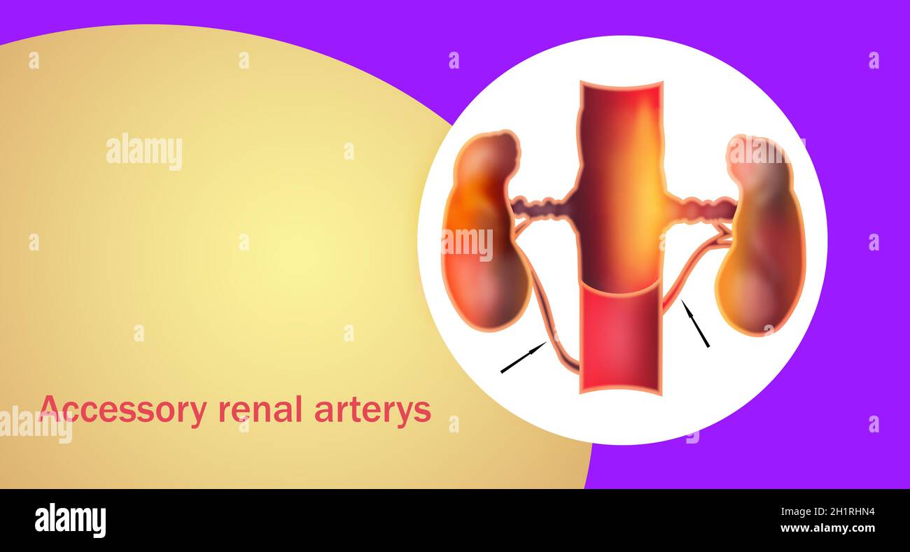 Die zusätzlichen Nierenarterien oder Aras sind embryonale Überreste, die bei mehr als einem Drittel der Patienten gefunden werden und bei 10 Prozent des Populs bilateral auftreten Stockfoto
